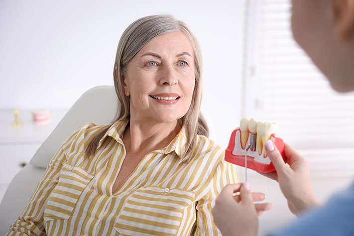 Denture Implant Bridges in florida